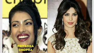 20 Bollywood Actresses Shocking Transformation 2018 | 2018 Then And Now