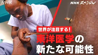 [NHKスペシャル] お灸、鍼(はり)、漢方薬…東洋医学がなぜ効くのか？最新科学で解明！| 東洋医学を“科学”する 〜鍼灸(しんきゅう)・漢方薬の新たな世界〜 | NHK