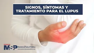 Signos, síntomas y tratamiento para el lupus #ExclusivoMSP