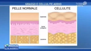 Grasso e cellulite addio