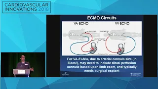 CVI2018 Session: When to use hemodynamic support & device selection - Ajay Kirtane, MD