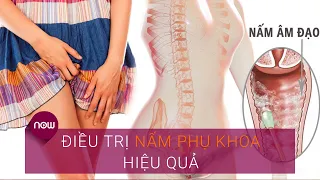 Nhận biết sớm, điều trị nấm phụ khoa hiệu quả | VTC Now