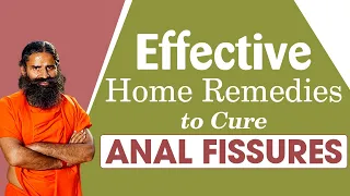 Effective Home Remedies To Cure Anal Fissures | Swami Ramdev