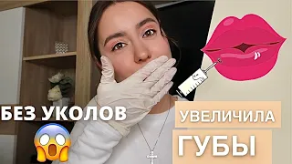 УВЕЛИЧИЛА САМА СЕБЕ  ГУБЫ💉😱 ГИАЛУРОН ПЕН | БЕЗЫГОЛЬНОЕ УВЕЛИЧЕНИЕ ГУБ