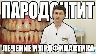 ПАРОДОНТИТ. Причины и Лечение