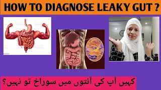 10 Signs That You Have a Leaky Gut /Leaky Gut Kaya Ha