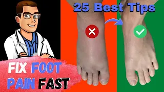 Broken Foot, Sprained Foot & Stress Fracture Treatment [25 Best Tips]