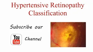 Hypertensive Retinopathy Classification / Grading || Ocular Disease || Optometry Club ||