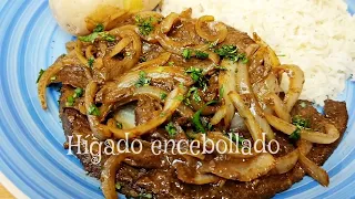 HÍGADO ENCEBOLLADO