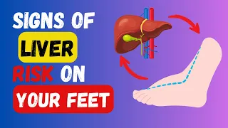 15 Secrets Your Feet Can Uncover About Your Liver Health