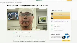 SoCal Lyft driver left bloodied after vicious attack by passenger | ABC7