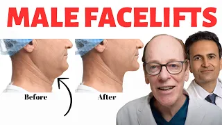 Male Facelifts | Plastic Surgeons Discuss