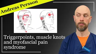 Trigger points, muscle knots and myofascial pain syndrome