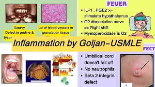 USMLE Inflammation - by Goljan the best