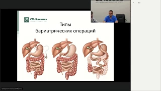 Запись вебинара «Различия бариатрических операций» - Давыдов В.Г. (14.02.2018)