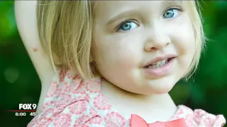 2 year old diagnosed with melanoma