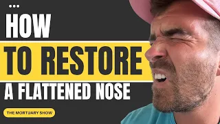 How to Restore a Flattened Nose 👃