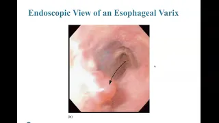 PEC Chapter 23 Abdominal, Hematologic, Gynecologic, Genitourinary, and Renal Emergencies