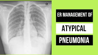 Atypical Pneumonia || Clinical features & Management