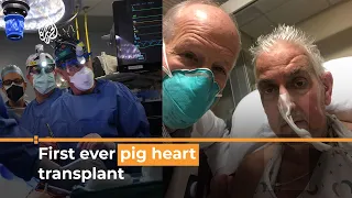 US man recovering after ‘breakthrough’ pig heart transplant