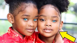 Remember the Most Beautiful Blue-Eyed Twins in the World? This Is What Happened to Them!