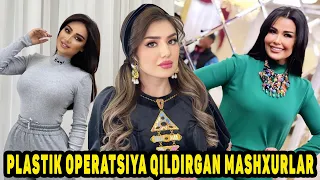 QOVOQ BURUN OSHQOZON !!! Plastik Operatsiya Qildirgan O'zbek Mashxurlari !!!