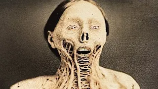 Most TERRIFYING Diseases In History
