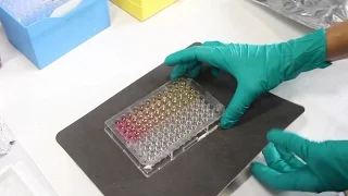 Conceptos básicos de la técnica ELISA. Protocolo del ELISA en Sandwich.