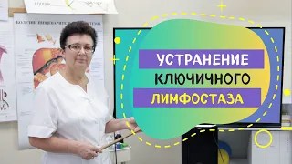 УСТРАНЕНИЕ КЛЮЧИЧНОГО ЛИМФОСТАЗА