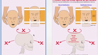 Trauma Part 1 - Assessing Airway WITH CERVICAL SPINE CONTROL