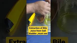Extraction of Bile juice from Gall bladder . Biology Lover ♥️ Must watch #shorts #viral #viral