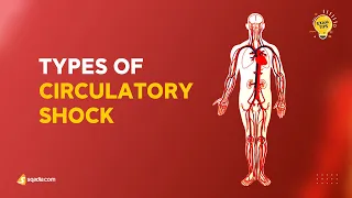 Types of Circulatory Shock | Emergency Medicine Lecture | V-Learning™ | sqadia.com