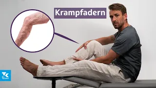 Krampfadern (Varizien) verstehen: Ursachen, Symptome, Diagnose & Therapie | DocTommy