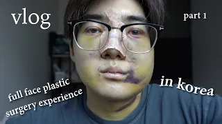 my plastic surgery journey in Korea (facial contouring, rhinoplasty, double eyelid surgery) vlog