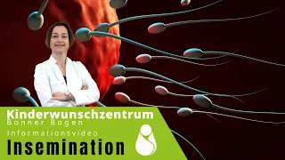 Intrauterine Insemination (IUI) - Ablauf, Voraussetzungen und Chancen