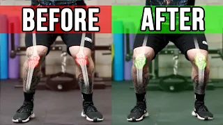 How to Fix Knee Cave in the Squat (And Should You Bother?)