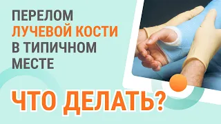 👀 Перелом лучевой кости в типичном месте - что делать?