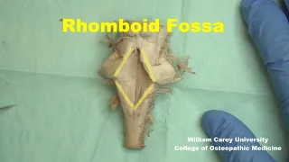 Rhomboid fossa of the human brainstem. Floor of fourth ventricle #brainstem#neuroanatomy #brain