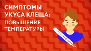 Клещи «Это должен знать каждый»