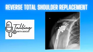 Reverse Total Shoulder Replacement