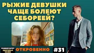 15 лет с себореей закончились после... лечения от Павла Ястремского