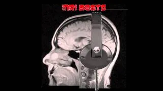 MRI Beats