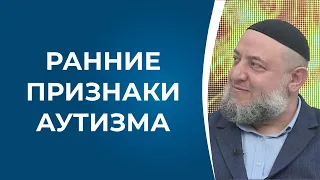 Ранние признаки аутизма. Давид Эйхель - основатель Центра "BEER DAVID" на ТВ "Kanal S" г.Баку