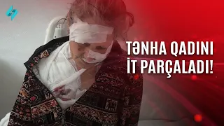 Tənha qadını it parçaladı… | Kanal S Xəbər