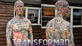 Today You'll See Me With NO Tattoos | TRANSFORMED