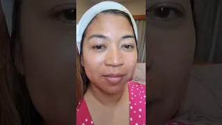 Cosmelan Peel for Acne Scars and  Skin Discoloration (Anti-ageing/Skin Rejuvenation) Days 1 & 2