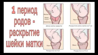 1 период родов (раскрытие шейки матки)!