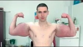 Hulk Ruso Pierde el brazo