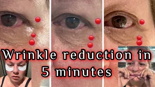 REDUCE WRINKLES IN 5 MINUTES. How to reduce wrinkles on face quickly @katesomervilleskincare