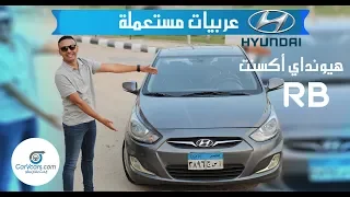 هيونداى اكسنت ار بى عيوب ومميزات مع عمرو حافظ–  Hyundai Accent RB